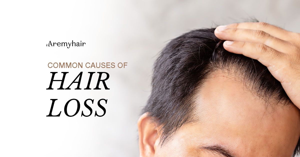 common-causes-of-hair-loss-blog-image-aremyhair