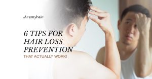 6 Tips for Hair Loss Prevention Main Image
