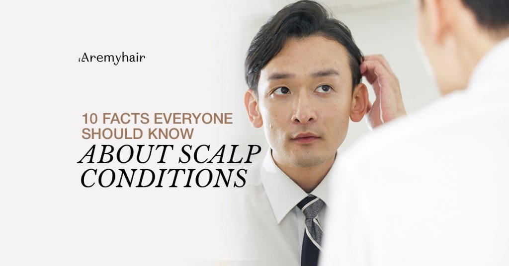 10 Facts Everyone Should Know About Scalp Conditions - Aremyhair Singapore Blog