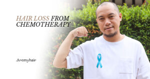 Hair Loss from Chemotherapy Blog Image - Aremyhair Singapore